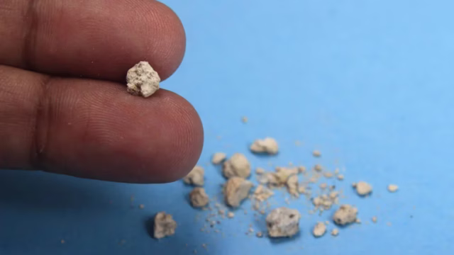 Infusiones para los riñones: qué se sabe sobre el diente de león. Imagen destacada sobre infusiones para los riñones. publicada en Noticias Web