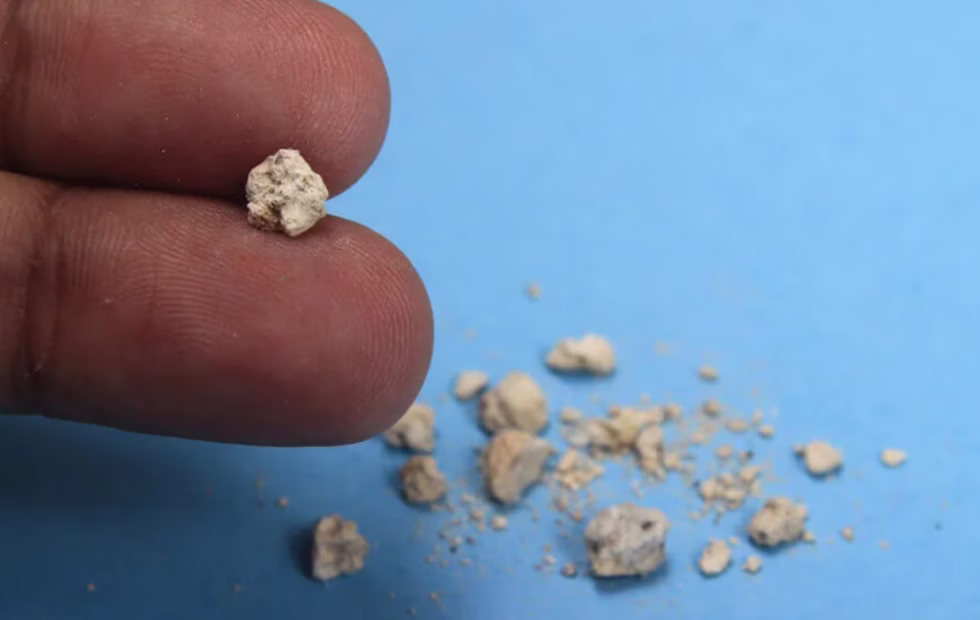 Infusiones para los riñones: qué se sabe sobre el diente de león. Imagen destacada sobre infusiones para los riñones. publicada en Noticias Web